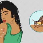 A couple was seriously injured in a bee attack in Belkappi village. They were referred