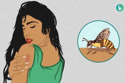 A couple was seriously injured in a bee attack in Belkappi village. They were referred