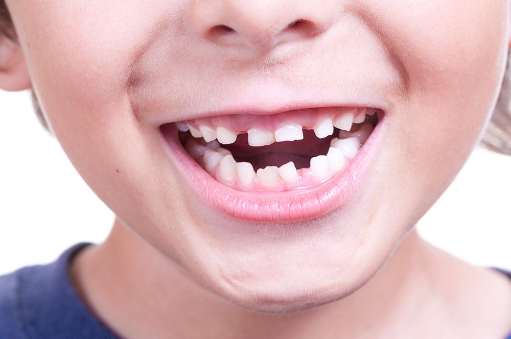 Milk teeth are the foundation of childrens future negligence can prove costly Dr. Chandan Kumar